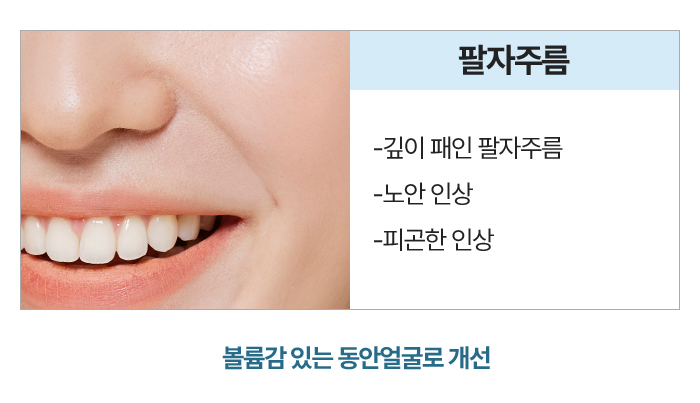 팔자주름