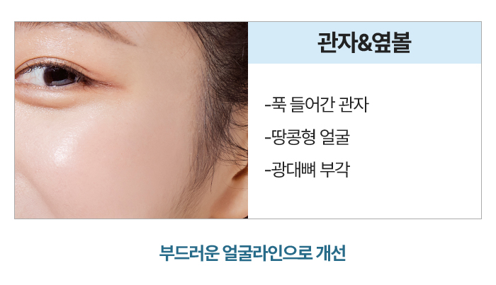 관자,옆볼