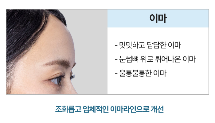 이마