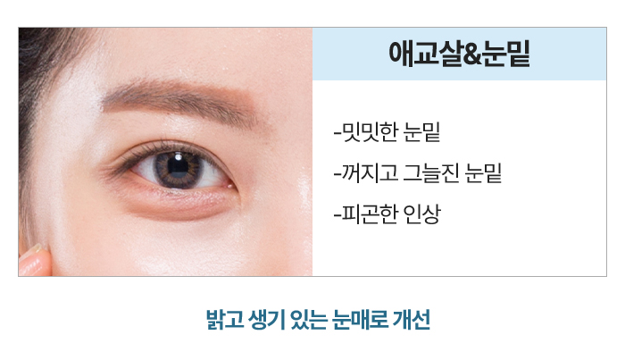 애교살,눈밑